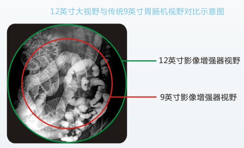 數字胃腸機優勢與檢查效果